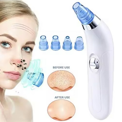 Facial Blackhead Removal Vaccum Pore Vacuum Blackhead Removal Tool