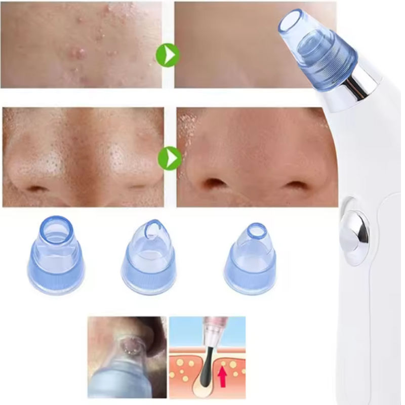 Facial Blackhead Removal Vaccum Pore Vacuum Blackhead Removal Tool